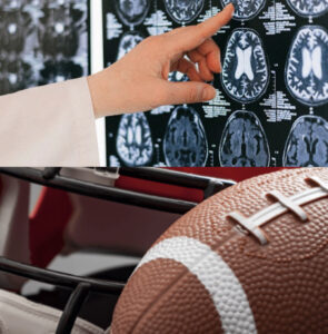 Per NFL Concussions Decreased To A Historic Low In 2024 Season