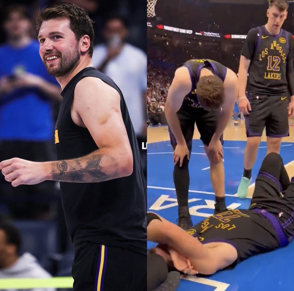 Los Angeles Lakers’ Luka Doncic Suffered a Grade 2 Hamstring Strain—Out Indefinitely